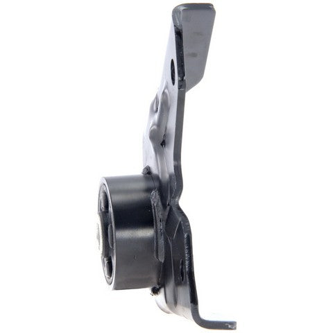 Differential Mount Anchor 3473